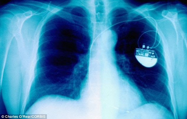 Medically minded: The study polled people on what they thought were the top inventions of the past century. While the internet and email came first, keyhole surgery and pacemakers (pictured) are among the top five innovations voted for by the British public
