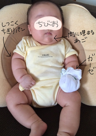 爪切りで出血 注 痛い思い出シリーズ ちびお日記