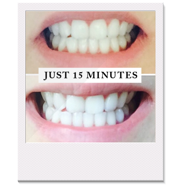 Pearly Whites - Special Offer 'Best Friends' Teeth ...
