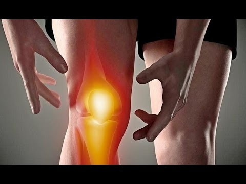 Video Obat Sendi Nyeri Lutut