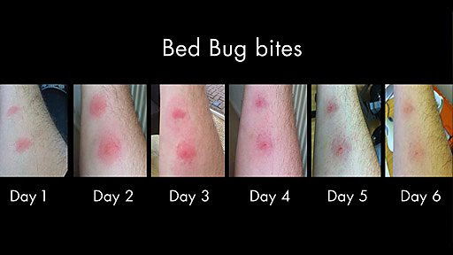 bed bugs bite and what we can do to stop them if anything when the bed ...
