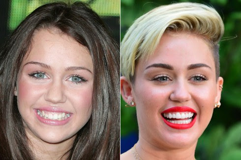 mileycyrusteeth2
