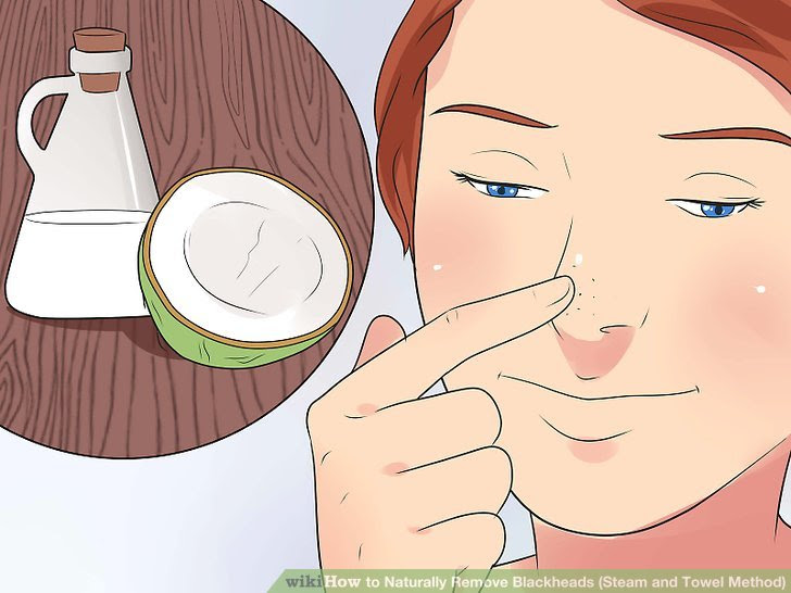 Naturally Remove Blackheads (Steam and Towel Method) Step 9.jpg