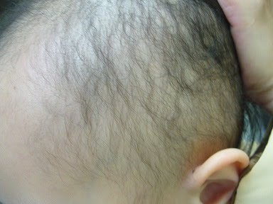 髪が生えてこない 乏毛症や無毛症とは 3歳からのグローバル教育に迷ったら 子どもの生きる力を育む教育専門家 エグゼクティブサポート コンサルティング ベビーシッティング 国際マナー せかいく