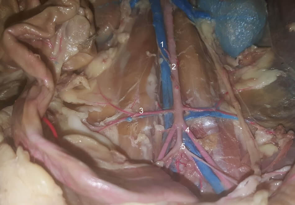 Quiz – Abdominal Vessels of the Cat