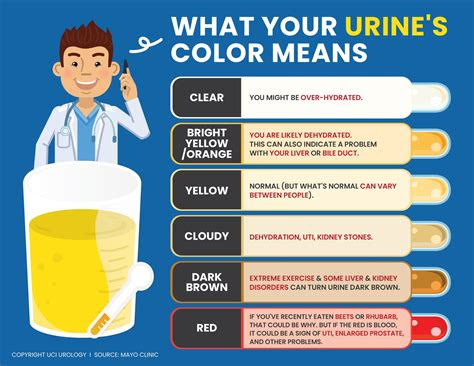  infographics urologist uc irvine department of urology