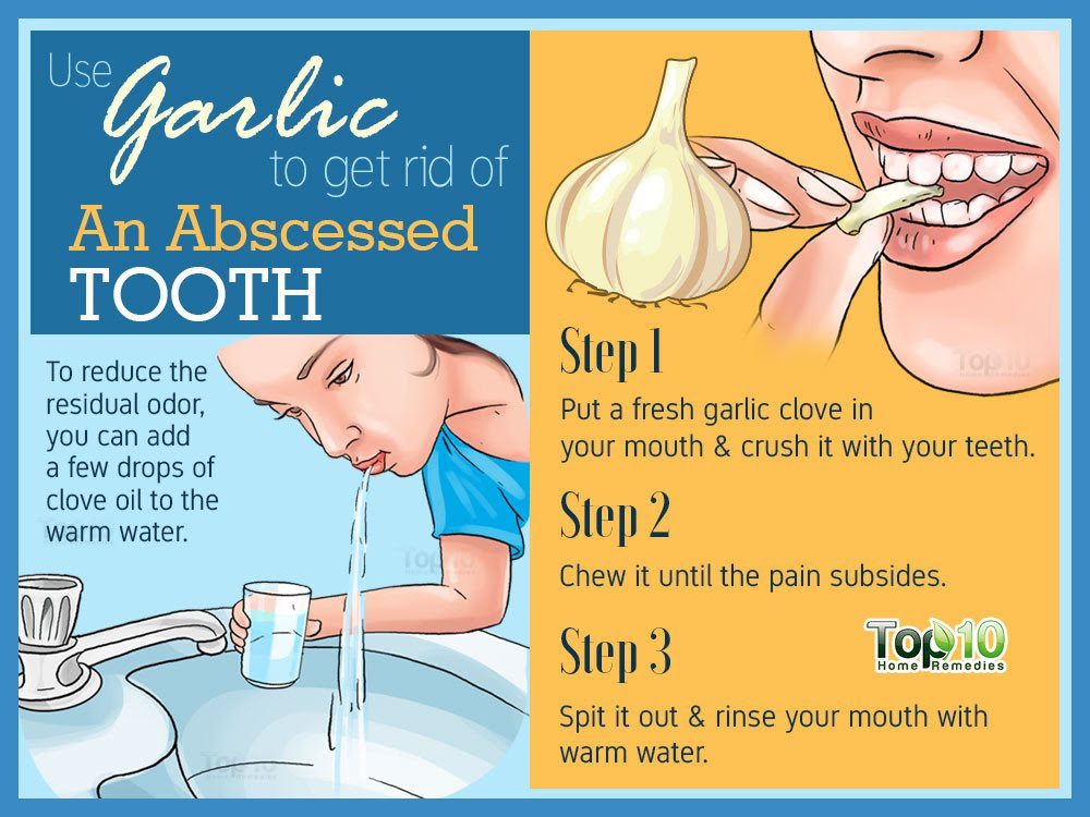 Abscess in tooth pain