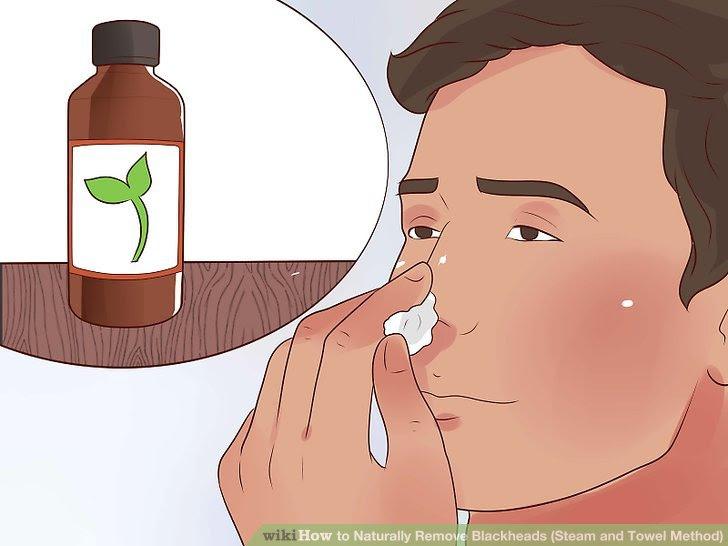Naturally Remove Blackheads (Steam and Towel Method) Step 5 Version 3.jpg