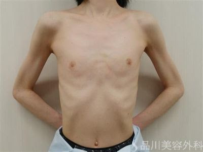 狂乱 ヒープ 平衡 胸 A カップ ない Fxlu Jp