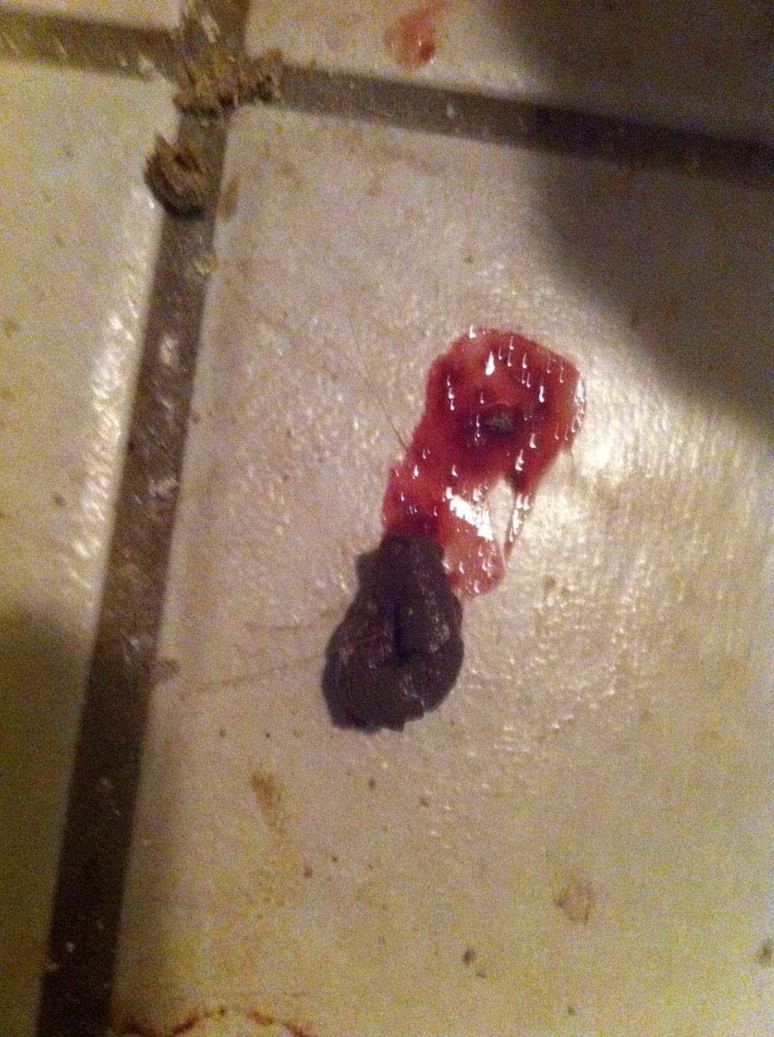 Bloody poop