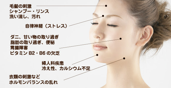 ニキビ あおぞら皮膚科 ニキビ治療 ニキビ跡の治療を承ります