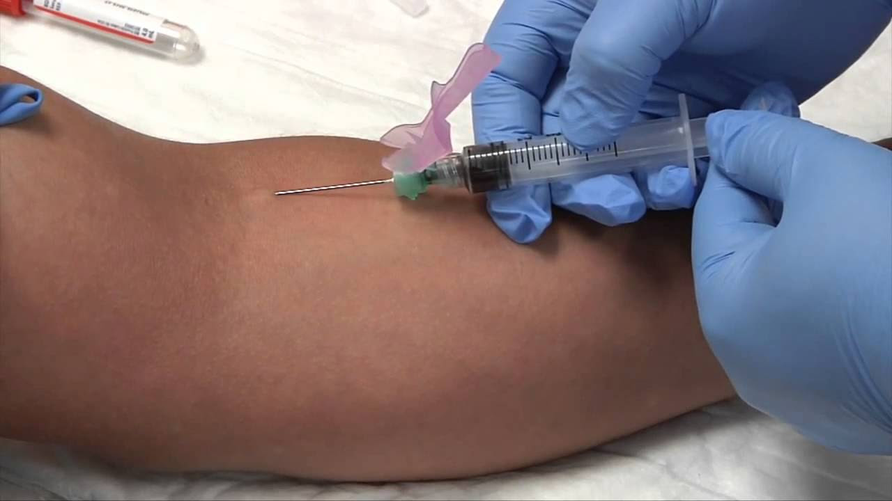Phlebotomy: Syringe Draw Procedure | Blood Collection (Rx ...