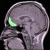 http://giaodiemonline.com/2012/05/images/zen02.jpg