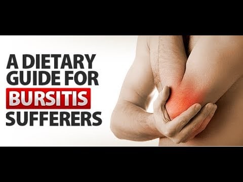 A Dietary Guide for Bursitis Sufferers
