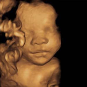 Here I Am Mommy The Home Of 3d 4d High Def Ultrasound