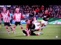 [HD] Luke Shaw leg break