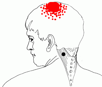 Pain Right Side Of P Of Head