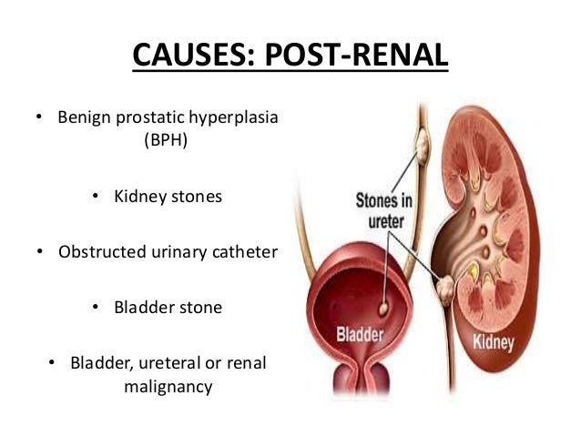 dialysis emergency treatment
