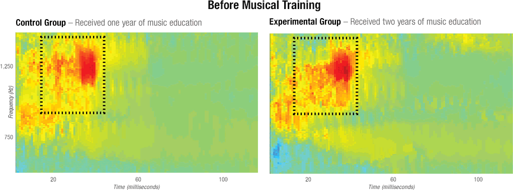 Responsiveness to Sounds