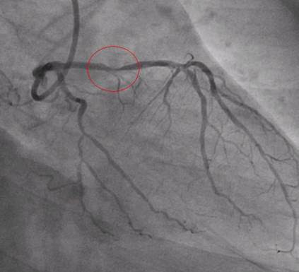  diagram lungs; human heart blood flow diagram skeleton fill in the blank 