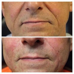 Corona Hair and Skin Clinic - Tattoo Removal - Yelp
