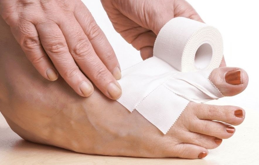 Cara paling Mudah dan Murah untuk Mencegah Kaki Melecet 