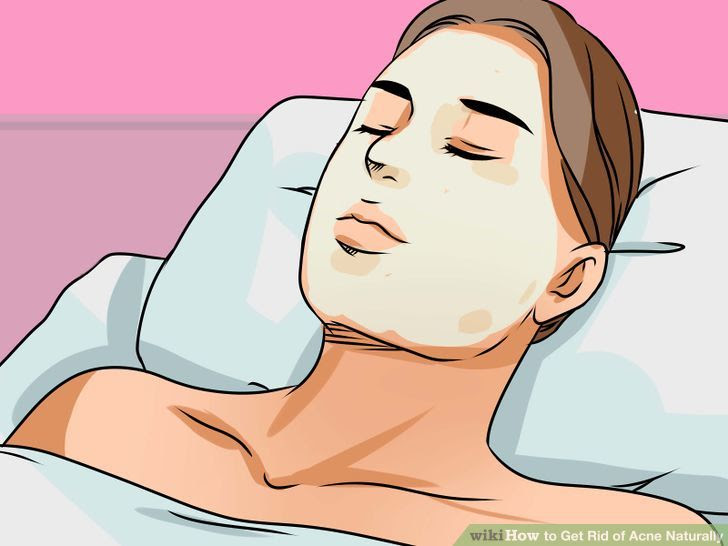 Get Rid of Acne Naturally Step 12 Version 2.jpg