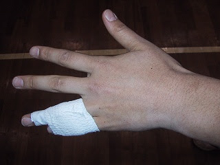 手のテーピング