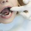 States with the lowest amount of trips to the dentist linked to high rates of missing teeth