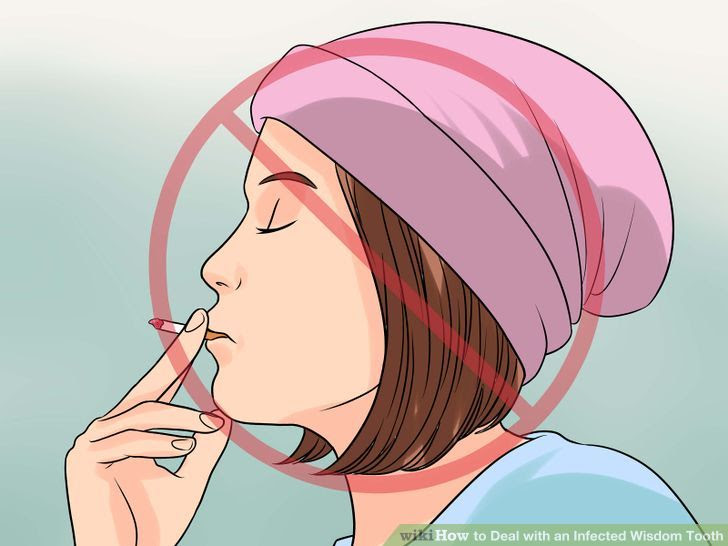 Deal with an Infected Wisdom Tooth Step 16.jpg