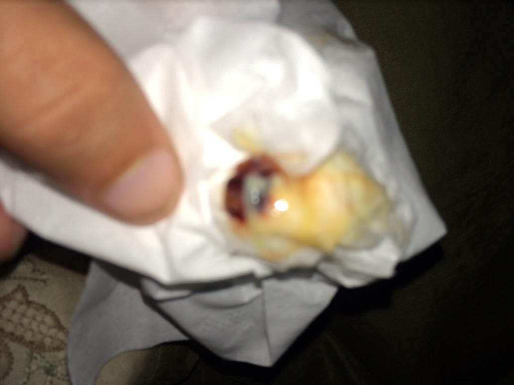 Coughing Up Green Mucus