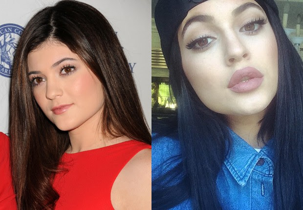 Kylie Jenner em 2013 e em 2014 (Foto: getty Images e Reprodução/Instagram)