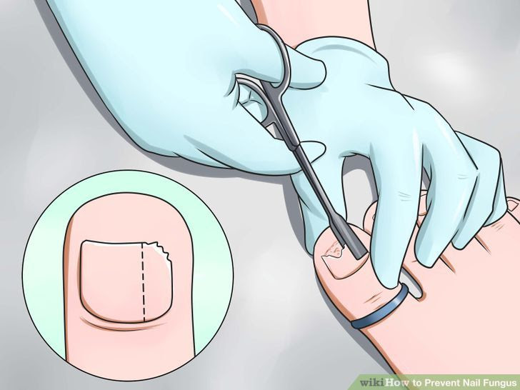 Prevent Nail Fungus Step 12.jpg