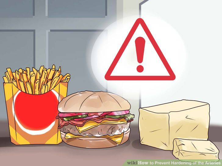 Prevent Hardening of the Arteries Step 2 Version 2.jpg