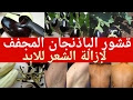 وصفة يوسف الشرفا لازالة الشعر