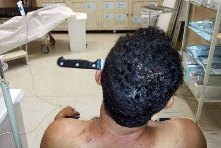 Homem ficou com a faca cravada na cabeça / Divulgação/Polícia Militar