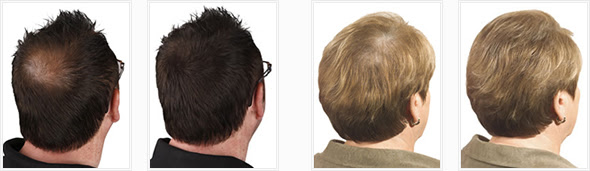 bob frisuren längliches gesicht