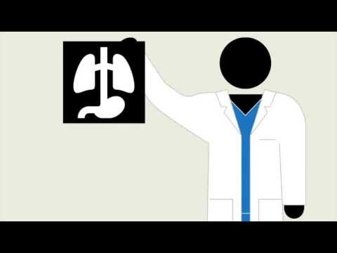 Youtube Mesothelioma Settlements