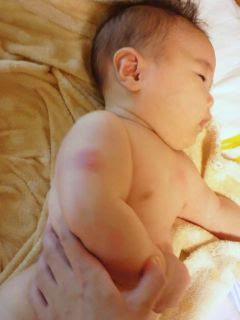 肺炎球菌１回目 Woooo