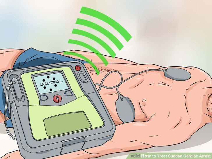Use a Defibrillator Step 9.jpg