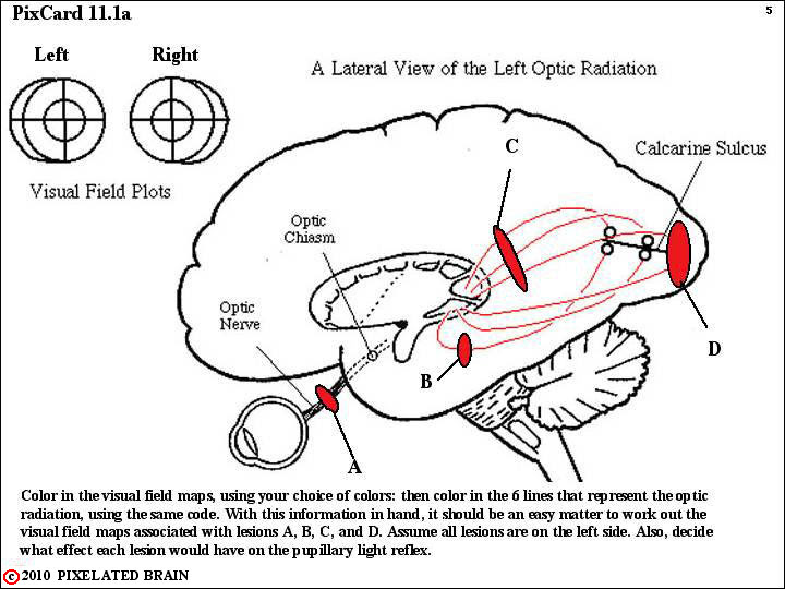 Download Pixelated Brain: Neuroanatomy for Medical Students