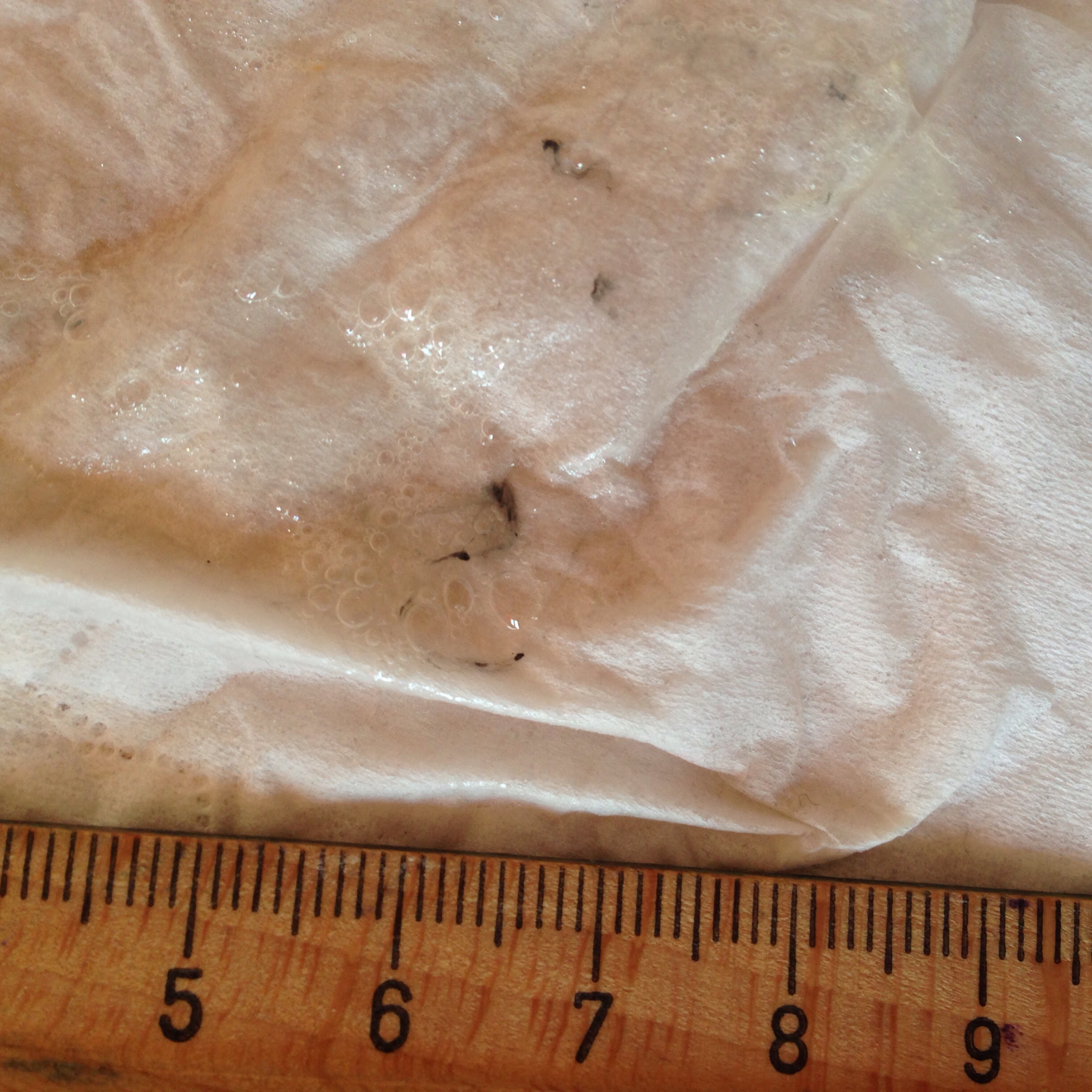 Auswurf Mit Schwarzen Schlieren E Zigi Eve Rave Das Schweizer Drogenforum Fur Risikobewussten Und Selbstverantwortlichen Umgang Mit Drogen