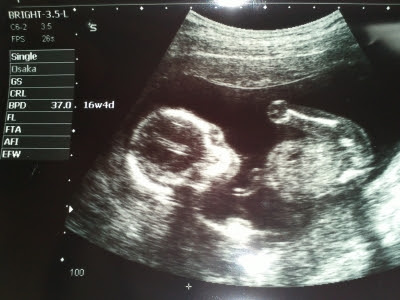 １６w１d 性別判明 Tracking My Baby S Growth