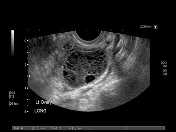 Ultrasound Gynecological Ultrasound Eastern Western Hospital