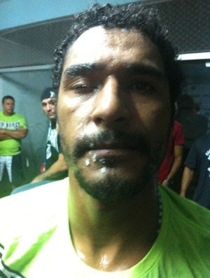 MMA Lutador Carlos Alberto Lobo, Cola (Foto: Ana Hissa)