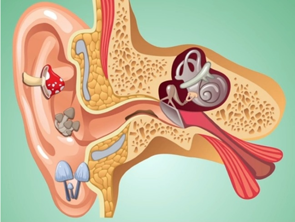 تنظيف الأذن 