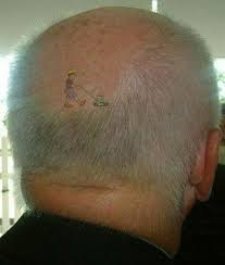 Best Hair Loss Treatment Organin 
