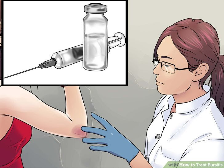 Treat Bursitis Step 9.jpg
