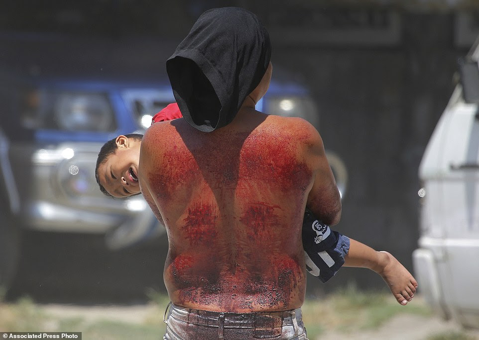 A hooded Filipino penitent plays with his son after his flaggelation during Good Friday rituals to atone for sins