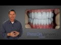 The SECRET about Veneers- No Dentist wants you to see these Prices